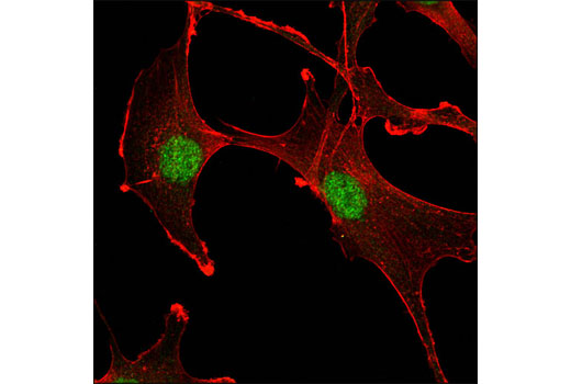 Confocal immunofluorescent analysis of A172 cells using Ubc9 (D26F2) XP ® Rabbit mAb (green). Actin filaments were labeled with DY-554 phalloidin (red).