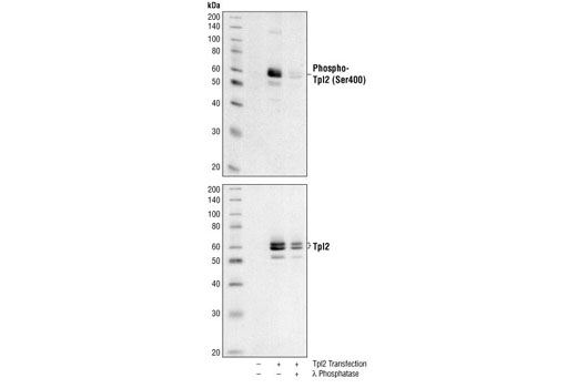 Western blot analysis of extracts from COS cells, untransfected or transfected with rat Tpl2 , using Phospho-Tpl2 (Ser400) Antibody (upper) and Tpl2 Antibody #4492 (lower). In lane 3, Tpl2 transfected COS cell lysate was treated with λ phosphatase to demonstrate the phospho-specificity of Phospho-Tpl2 (Ser400) Antibody.