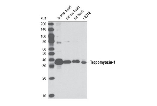 Western blot analysis of extracts from human, mouse and rat heart tissue and C2C12 cells using Tropomyosin-1 (D12H4) Rabbit mAb.