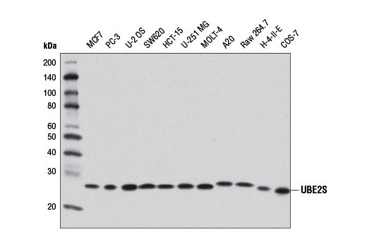 Western blot analysis of extracts from various cell lines using UBE2S (D5H9H) Rabbit mAb.