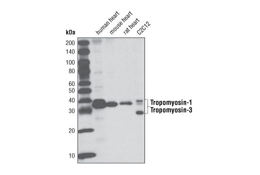 Western blot analysis of extracts from human, mouse and rat heart tissue and C2C12 cells using Tropomyosin-1/3 (D17B8) Rabbit mAb.