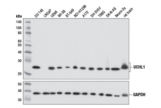 Western blot analysis of extracts from various cell lines and rat brain tissue using UCHL1 (D8R2I) XP ® Rabbit mAb (upper) or GAPDH (D16H11) XP ® Rabbit mAb #5174 (lower).