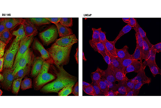 Confocal immunofluorescent analysis of DU 145 (positive; left) and LNCaP (negative; right) cells using UCHL1 (D8R2I) XP ® Rabbit mAb (green). Actin filaments were labeled with DY-554 phalloidin (red). Blue pseudocolor = DRAQ5 ® #4084 (fluorescent DNA dye).