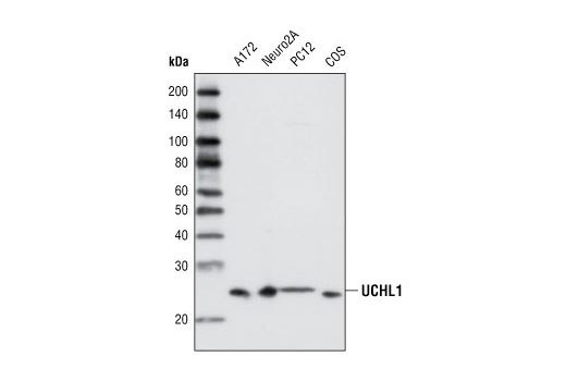 Western blot analysis of extracts from various cell types using UCHL1 Antibody.