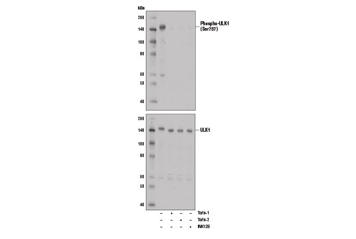 Western blot analysis of extract from A172 cells, untreated (-) or treated with mTOR inhibitors, either Torin-1 (250 nM, 5 hrs), Torin-2 (250 nM, 5 hrs), or INK128 (250 nM, 5 hours) using Phospho-ULK1 (Ser757) (D7O6U) Rabbit mAb (upper) or ULK1 (D8H5) Rabbit mAb #8054 (lower).