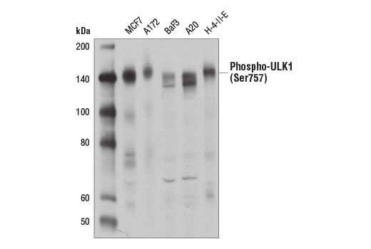 Western blot analysis of extracts from various cell lines using Phospho-ULK1 (Ser757) (D7O6U) Rabbit mAb.