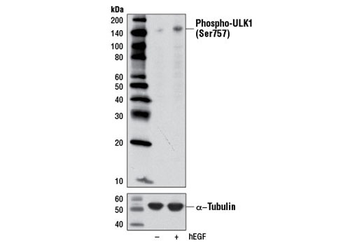 Western blot analysis of extracts from A-431 cells, untreated or treated with Human Epidermal Growth Factor (hEGF) #8916 (100 ng/ml, 30 min) using Phospho-ULK1 (Ser757) Antibody (upper), or α-Tubulin (11H10) Rabbit mAb #2125 (lower).