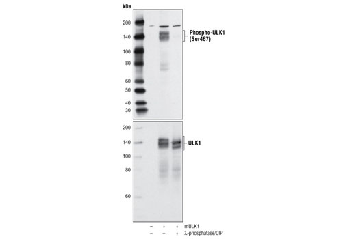 Western blot analysis of extracts from mock transfected and mouse ULK1 (mULK1) transfected 293T cells, untreated or treated with λ-phosphatase and calf intestinal phosphatase (CIP), using Phospho-ULK1 (Ser467) Antibody (upper) or ULK1 (R600) Antibody #4773 (lower).