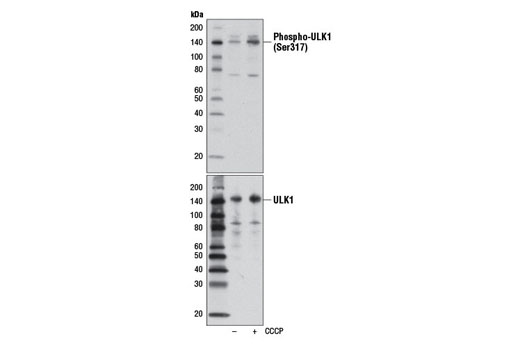 Western blot analysis of extracts from MCF7 cells, untreated (-) or treated with carbonyl cyanide 3-chlorophenylhydrazone (CCCP) (100 μM, 2 hr; +), using Phospho-ULK1 (Ser317) (D2B6Y) Rabbit mAb (upper) or ULK1 (D8H5) Rabbit mAb #8054 (lower).