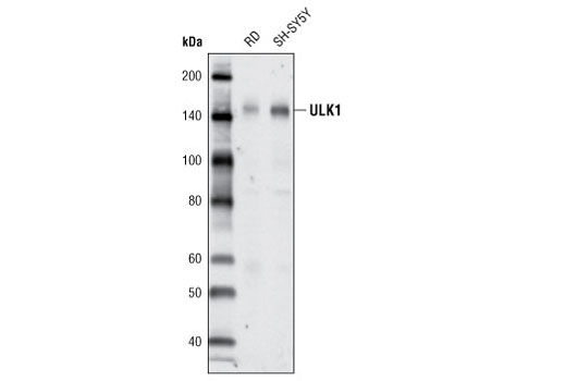 Western blot analysis of extracts from RD and SH-SY5Y cells using ULK1 (A705) Antibody.