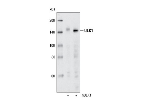 Western blot analysis of extracts from COS cells, untransfected (-) or transfected with a construct overexpressing human ULK1 (+), using ULK1 (R600) Antibody.