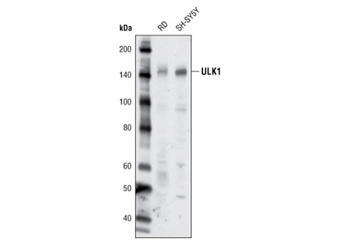 Western blot analysis of extracts from RD and SH-SY5Y cells using ULK1 (R600) Antibody.