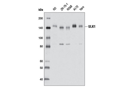 Western blot analysis of extracts from various cell lines using ULK1 (D9D7) Rabbit mAb.