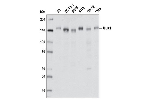 Western blot analysis of extracts from various cell lines using ULK1 (D8H5) Rabbit mAb.
