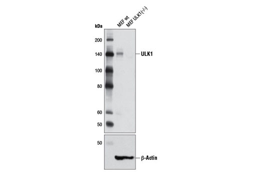 Western blot analysis of extracts from wild-type MEF and ULK1 (-/-) MEF cells using ULK1 (D8H5) Rabbit mAb (upper) and β-Actin (D6A8) Rabbit mAb #8457 (lower). MEF cells were kindly provided by Dr. Reuben Shaw (Salk Institute, La Jolla, CA).