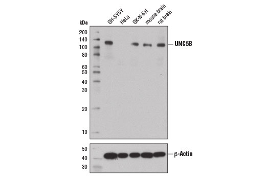 Western blot analysis of extracts from various cell lines and tissues using UNC5B (D9M7Z) Rabbit mAb (upper) and β-Actin (D6A8) Rabbit mAb #8457 (lower).