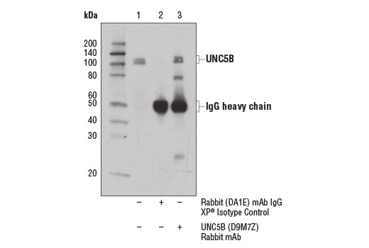 Immunoprecipitation of UNC5B from SH-SY5Y cell extracts using Rabbit (DA1E) mAb IgG XP ® Isotype Control #3900 (lane 2) or UNC5B (D9M7Z) Rabbit mAb (lane 3). Lane 1 is 10% input. Western blot analysis was performed using UNC5B (D9M7Z) Rabbit mAb.