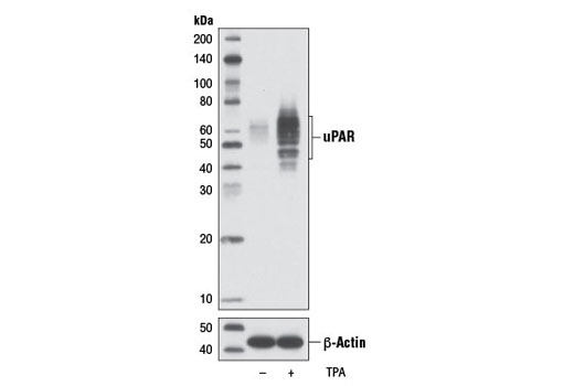 Western blot analysis of extracts from U-937 cells, untreated (-) or treated with TPA #4174 (200 nM, 72 hr; +), using uPAR (D4Q5S) Rabbit mAb (upper) or β-Actin (D6A8) Rabbit mAb #8457 (lower).