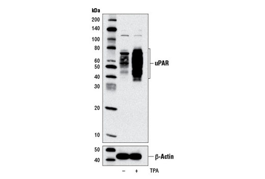 Western blot analysis of extracts from U-937 cells, untreated (-) or treated (+) with TPA #4174 (200 nM, 72 hr), using uPAR (D7X2N) Rabbit mAb (upper) or β-Actin (D6A8) Rabbit mAb #8457 (lower).