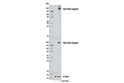 Western blot analysis of extracts from 293 cells, mock transfected (-) or transfected with a construct expressing Myc-tagged full-length human Upf2 (hUpf2-Myc; +), using Upf2 (D3B10) Rabbit mAb (upper), Myc-Tag (71D10) Rabbit mAb #2278 (middle), and β-Actin (D6A8) Rabbit mAb #8457.