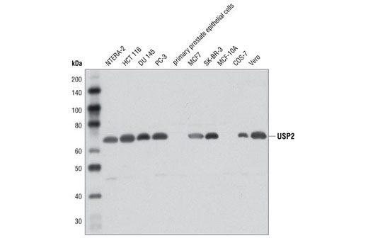 Western blot analysis of extracts from various cell lines using USP2 Antibody.