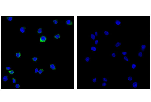 Confocal immunofluorescent analysis of RPMI 8226 (left) and THP-1 (right) cells using Toll-like Receptor 9 (D9M9H) XP ® Rabbit mAb (green). Blue pseudocolor = DRAQ5 ® #4084 (fluorescent DNA dye).