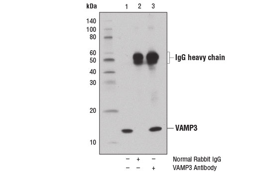 Immunoprecipitation of VAMP3 from SK-MEL-28 cell extracts using Normal Rabbit IgG #2729 (lane 2) or VAMP3 Antibody (lane 3). Lane 1 is 10% input. Western blot analysis was performed using VAMP3 Antibody.