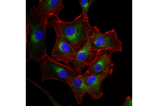 Confocal immunofluorescent analysis of A172 cells using VAMP7 (D8Y1R) Rabbit mAb (IF Specific) (green). Actin filaments were labeled with DyLight™ 554 Phalloidin #13054 (red). Blue pseudocolor = DRAQ5 ® #4084 (fluorescent DNA dye).