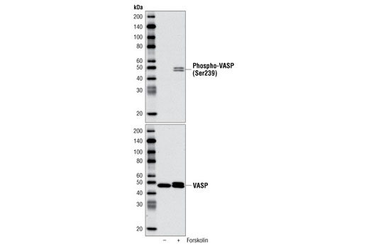 Western blot analysis of extracts from A-431 cells, untreated (-) or treated with Forskolin #3828 (+), using Phospho-VASP (Ser239) Antibody (upper) and VASP (9A2) Rabbit mAb #3132 (lower).