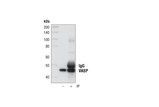 Immunoprecipitation of VASP from HeLa cell extracts using VASP Rabbit mAb. The same antibody was used for Western detection.
