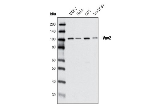 Western blot analysis of extracts from various cell types using Vav2 (C64H2) Rabbit mAb.