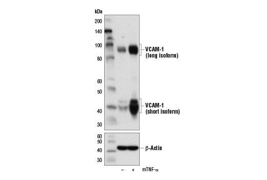Western blot analysis of extracts from MS-1 cells, untreated (-) or treated with Mouse Tumor Necrosis Factor-α (mTNF-α) #5178 (10 ng/ml, 16 hr; +), using VCAM-1 Antibody (Rodent Specific) (upper) and β-Actin (D6A8) Rabbit mAb #8457 (lower).