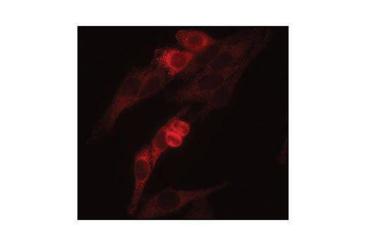 Immunofluorescence staining of paraformaldehyde-fixed HeLa cells, using VCP Antibody.