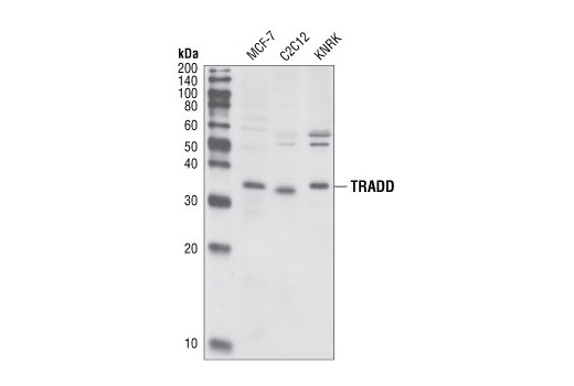 Western blot analysis of extracts from MCF-7 (human), C2C12 (mouse) and KNRK (rat) cell lines, using TRADD Antibody.