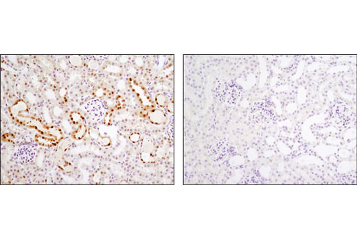 Immunohistochemical analysis of paraffin-embedded mouse kidney, Vdr (+/+; left) or Vdr (-/-; right), using Vitamin D3 Receptor (D2K6W) Rabbit mAb (Tissues courtesy of Dr. Marie Demay, Massachusetts General Hospital).