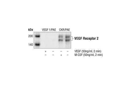 Western blot analysis of extracts from PAE cells overexpressing VEGF receptor 1 and chimeric VEGF receptor 2 respectively, using VEGF Receptor 2 Antibody. PAE/CKR cells overexpress chimeric receptors containing human CSF-1 extracellular binding domain/mouse VEGF receptor 2 intracellular domains.(7).