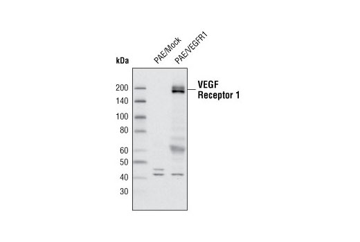 Western blot analysis of extracts from PAE cells transfected with either a mock expression vector or human VEGFR-1, using VEGF Receptor 1 Antibody.