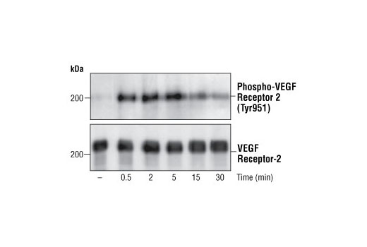 Western blot analysis of extracts of CKR/PAE cells expressing chimeric receptors containing human CSF-1 extracellular binding domain/mouse VEGFR-2 intracellular domains (Rahimi, N. et al. [2000] J. Biol. Chem. 275, 16986-16992), using Phospho-VEGF Receptor 2 (Tyr951) Antibody (upper) or VEGF receptor 2 antibody (lower).