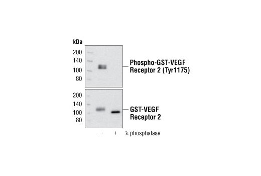 Western blot analysis of recombinant human GST-VEGF Receptor 2 (Val789-Val1356), untreated or λ phosphatase-treated, using Phospho-VEGF Receptor 2 (Tyr1212) (11A3) Rabbit mAb (upper) and VEGF Receptor 2 Antibody #2472 (lower).