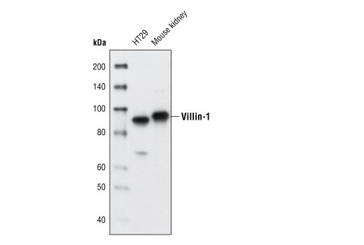 Western blot analysis of extracts from HT29 cells and mouse kidney using Villin-1 (R814) Antibody.