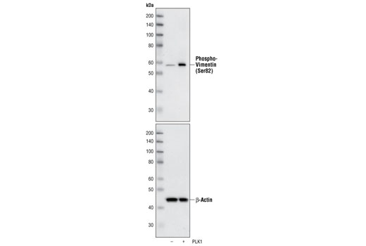 Western blot analysis of extracts from HeLa cells, untreated or phosphorylated in vitro by PLK, using Phospho-Vimentin (Ser83) Antibody (upper). β-Actin Antibody #4976 (lower) was used as a loading control.