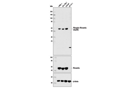 Western blot analysis of extracts from various cell lines using Phospho-Vimentin (Ser39) Antibody (upper), Vimentin (D21H3) XP ® Rabbit mAb #5741 (middle), and β-Actin (D6A8) Rabbit mAb #8457 (lower). Publications have shown that the human breast carcinoma cell line, ZR-75-1, does not express vimentin.