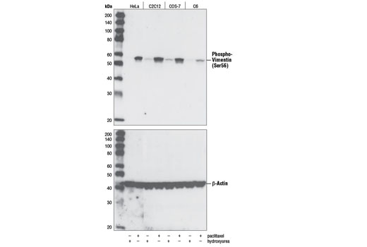 Western blot analysis of extracts from various cell types, hydroxyurea-treated (4 mM) (G1/S) or paclitaxel-treated (100 nM) (G2/M) for 20 hours, using Phospho-Vimentin (Ser56) Antibody (upper). β-Actin Antibody #4967 was used as a loading control (lower).