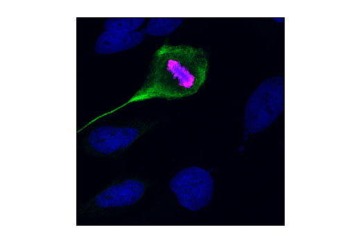 Confocal immunofluorescent analysis of HeLa cells using Phospho-Vimentin (Ser56) Antibody (green) and Phospho-Histone H3 (Ser10) (6G3) Mouse mAb #9706 (red). Blue pseudocolor = DRAQ5 ® #4084 (fluorescent DNA dye).