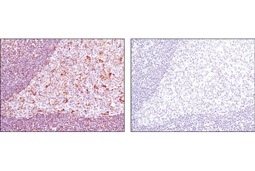 Immunohistochemical analysis of paraffin-embedded human tonsil using Vimentin (D21H3) XP ® Rabbit mAb in the presence of control peptide (left) or antigen-specific peptide (right).