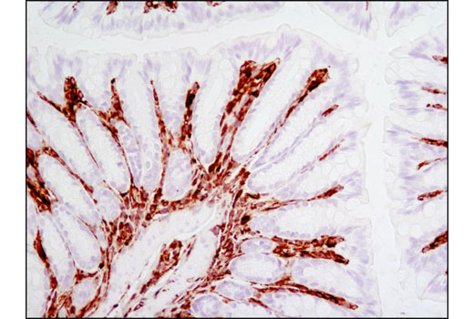 Immunohistochemical analysis of paraffin-embedded mouse colon using Vimentin (D21H3) XP ® Rabbit mAb.