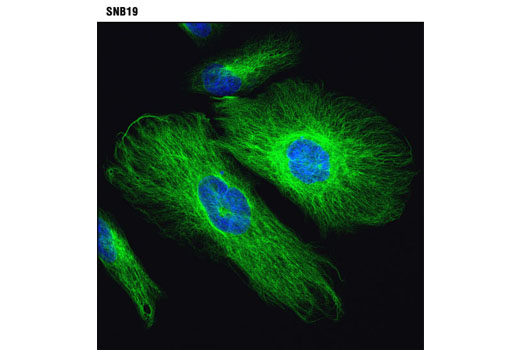 Confocal immunofluorescent analysis of SNB19 cells using Vimentin (D21H3) Rabbit mAb (green). Blue pseudocolor = DRAQ5 ® #4084 (fluorescent DNA dye).