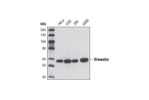 Western blot analysis of extracts from various cell types using Vimentin (5G3F10) Mouse mAb.