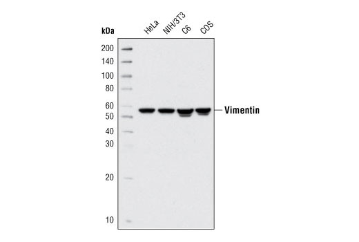 Western blot analysis of extracts from various cell lines using Vimentin (R28) Antibody.