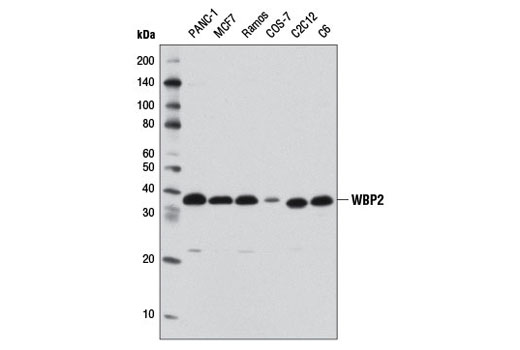 Western blot analysis of extracts from various cell lines using WBP2 Antibody.